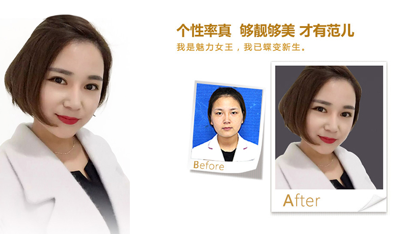 厦门美鼻、V脸