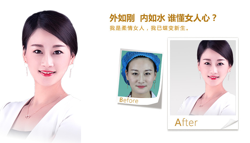 厦门V脸、线雕隆鼻